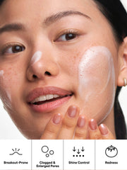 Extra Strength Acne Travel Trio
